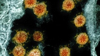 Novel Coronavirus SARS-CoV-2 virus particles, orange, isolated from a patient.