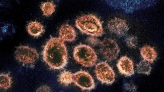 A photo shows a 2020 electron  microscope of SARS-CoV-2 virus particles that cause COVID-19.