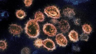 A microsocpe image of SARS-CoV-2 virus particles