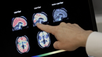 Study Finds Most Americans Unfamiliar With Signs Of Early Alzheimer's