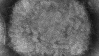 Microscopic image of monkeypox virion