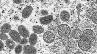An electron microscope image shows monkeypox virions
