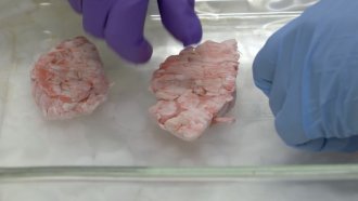 Researchers look at parts of a brain.