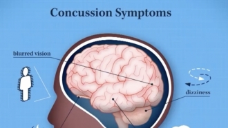 Concussion symptoms diagram