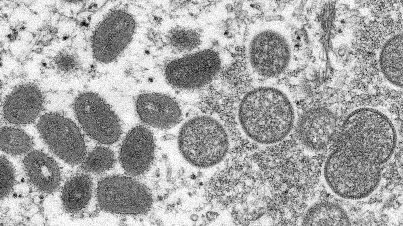 An electron microscope image hows mature, oval-shaped monkeypox virions.