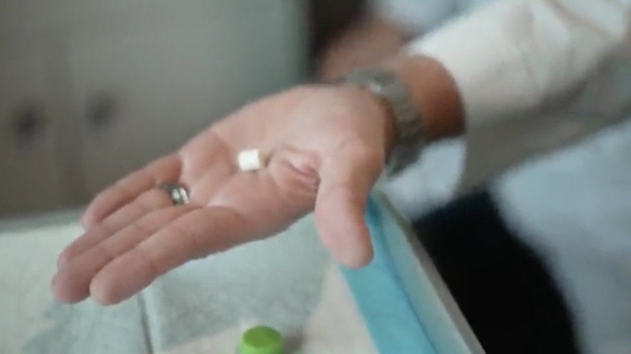 A doctor shows a Naltraxone implant.